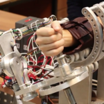 Design of a Robot Manipulator for Wrist and Forearm Rehabilitation: Performance Analysis and Clinical Results