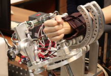 Design of a Robot Manipulator for Wrist and Forearm Rehabilitation: Performance Analysis and Clinical Results